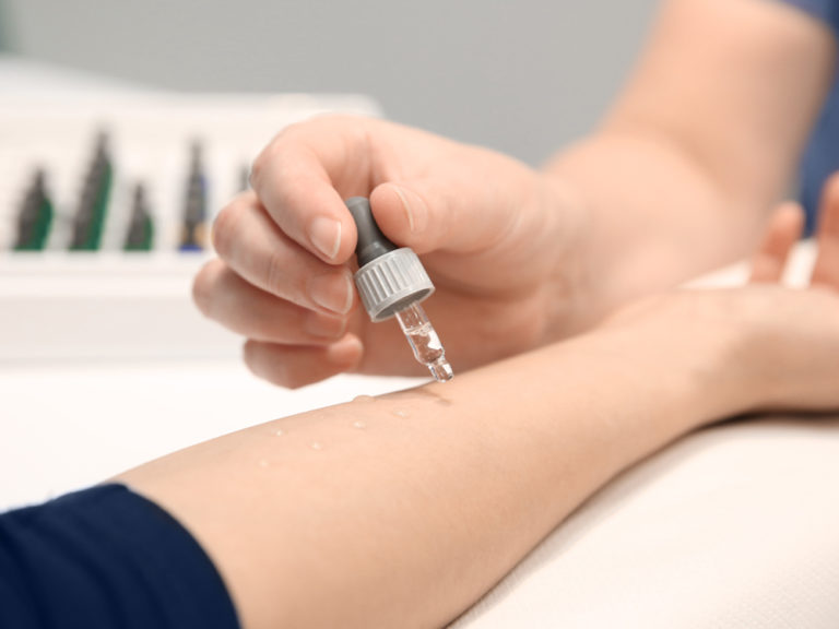 Allergie-Diagnostik-MEDIZINICUM-Allergologie