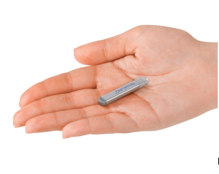 implantable loop recorder